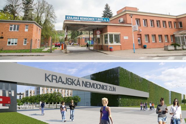 Stávající versus nová krajská nemocnice ve Zlíně | foto: Český rozhlas
